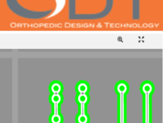 Orthopedic Design 2